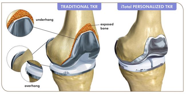 ConforMIS